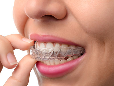Mainland Dental Associates | Teeth Whitening, Invisalign reg and Dental Cleanings