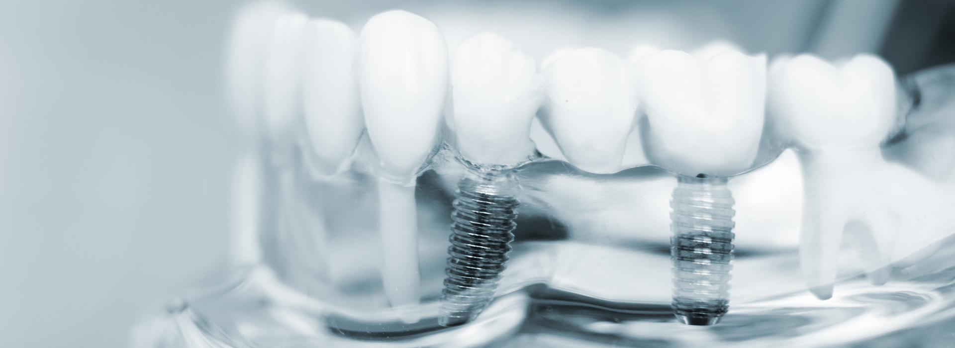 Mainland Dental Associates | Dentures, Botox reg and Emergency Treatment